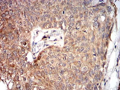 Валидация AntibodySystem RVV44801 (4209)