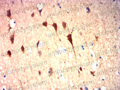 Валидация AntibodySystem RHF65305