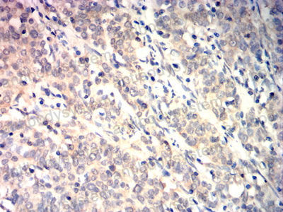 Валидация AntibodySystem RHN98302