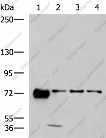 Вестерн-блоттинг, PPEF1, клетки 293T, A549 и A172