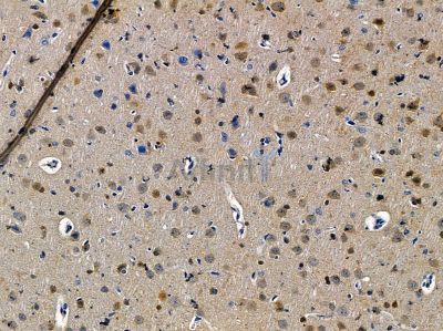 Валидация Affinity DF14407 - 10339