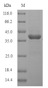 SDS-PAGE