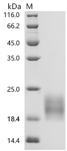 SDS-PAGE