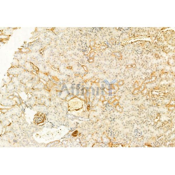 Валидация Affinity DF9198 - 21583