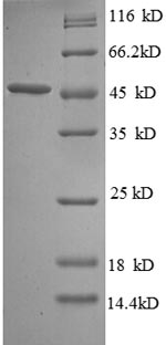 SDS-PAGE