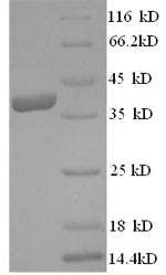 SDS-PAGE