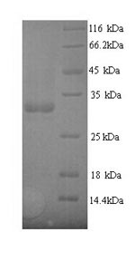 SDS-PAGE