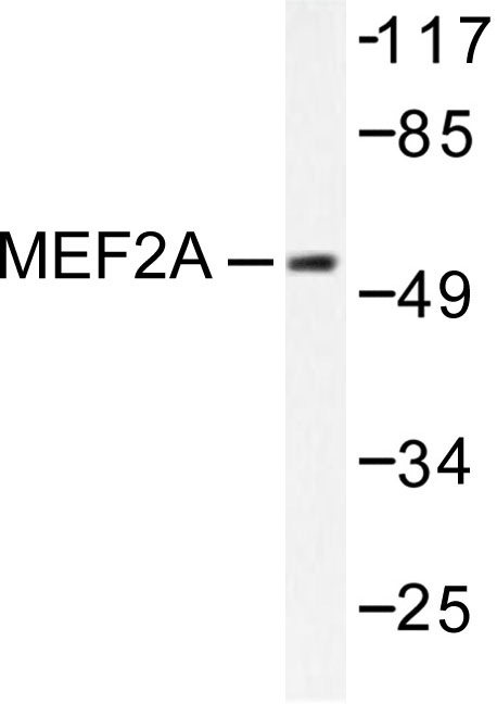Валидация AssayVector ARM1713(2009)