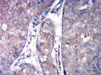 Валидация AntibodySystem RHC24501