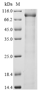 SDS-PAGE