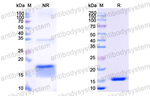 Валидация SDS-PAGE - AntibodySystem RHB86906