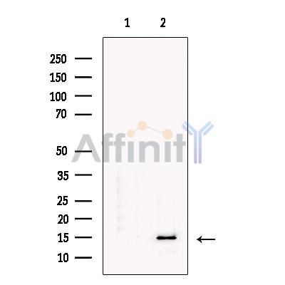 Валидация Affinity DF13514 - 8915