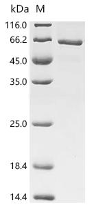SDS-PAGE
