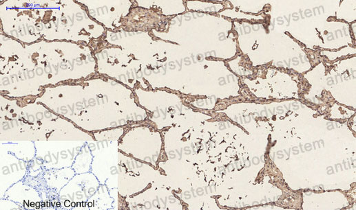 Валидация AntibodySystem RHC21301 (789)