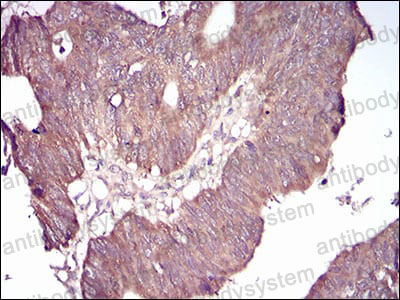 Валидация AntibodySystem RHE72104 (2278)