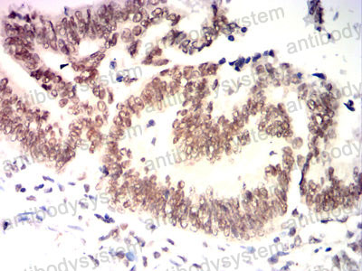 Валидация AntibodySystem RHD31503