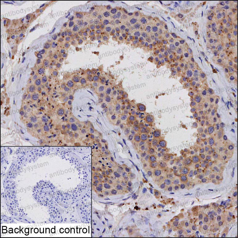 Валидация AntibodySystem RHH87102