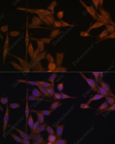 Иммунофлуоресценция, PP2A Catalytic α, клетки HeLa