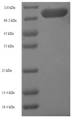 SDS-PAGE