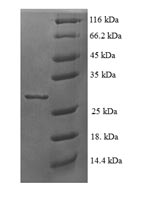 SDS-PAGE