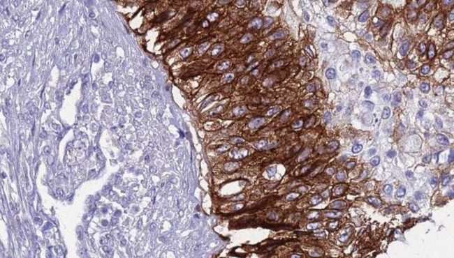 Валидация AssayVector ARM1171(475)