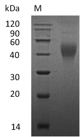 SDS-PAGE