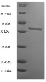 SDS-PAGE