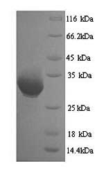 SDS-PAGE