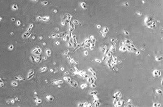 Валидация активности AntibodySystem AHC84101