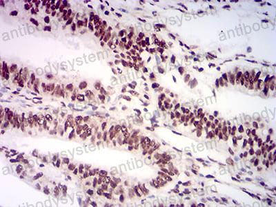 Валидация AntibodySystem RHN89403