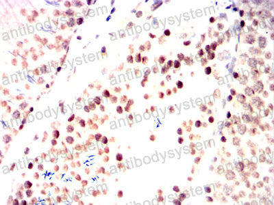 Валидация AntibodySystem RHE73903 (2303)