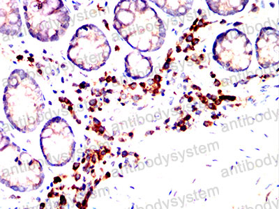 Валидация AntibodySystem RHD06804