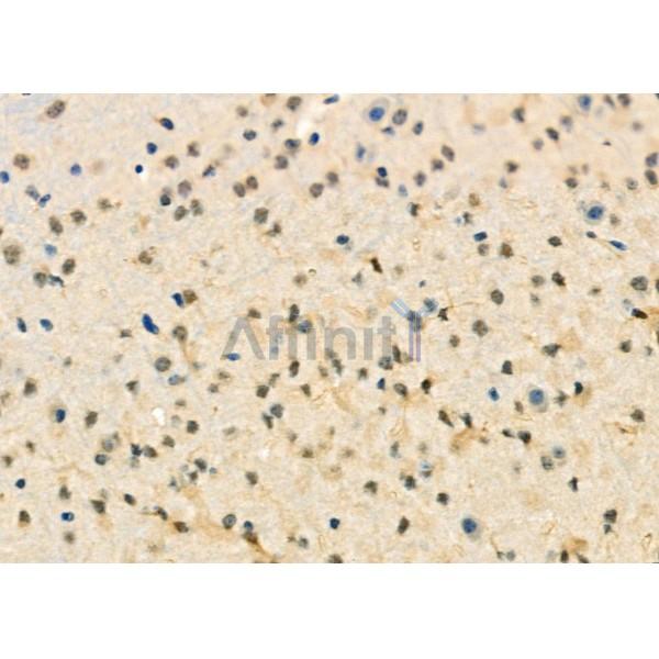 Валидация Affinity DF9057 - 21316