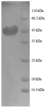 SDS-PAGE