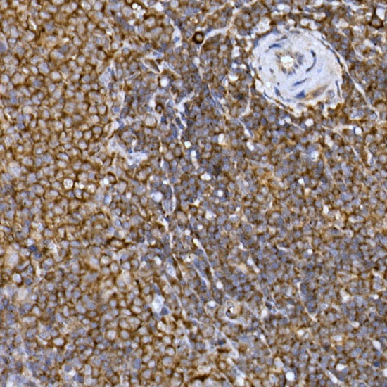 Иммуногистохимия, PRPSAP2, ткань селезенки крысы