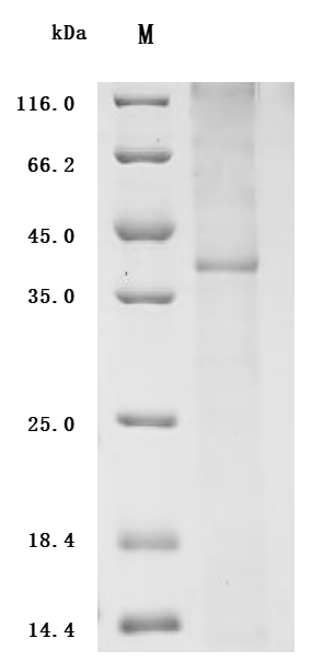 SDS-PAGE