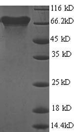 SDS-PAGE