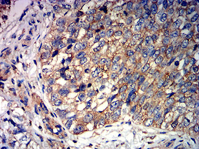 Валидация AntibodySystem RHJ81202 (3554)