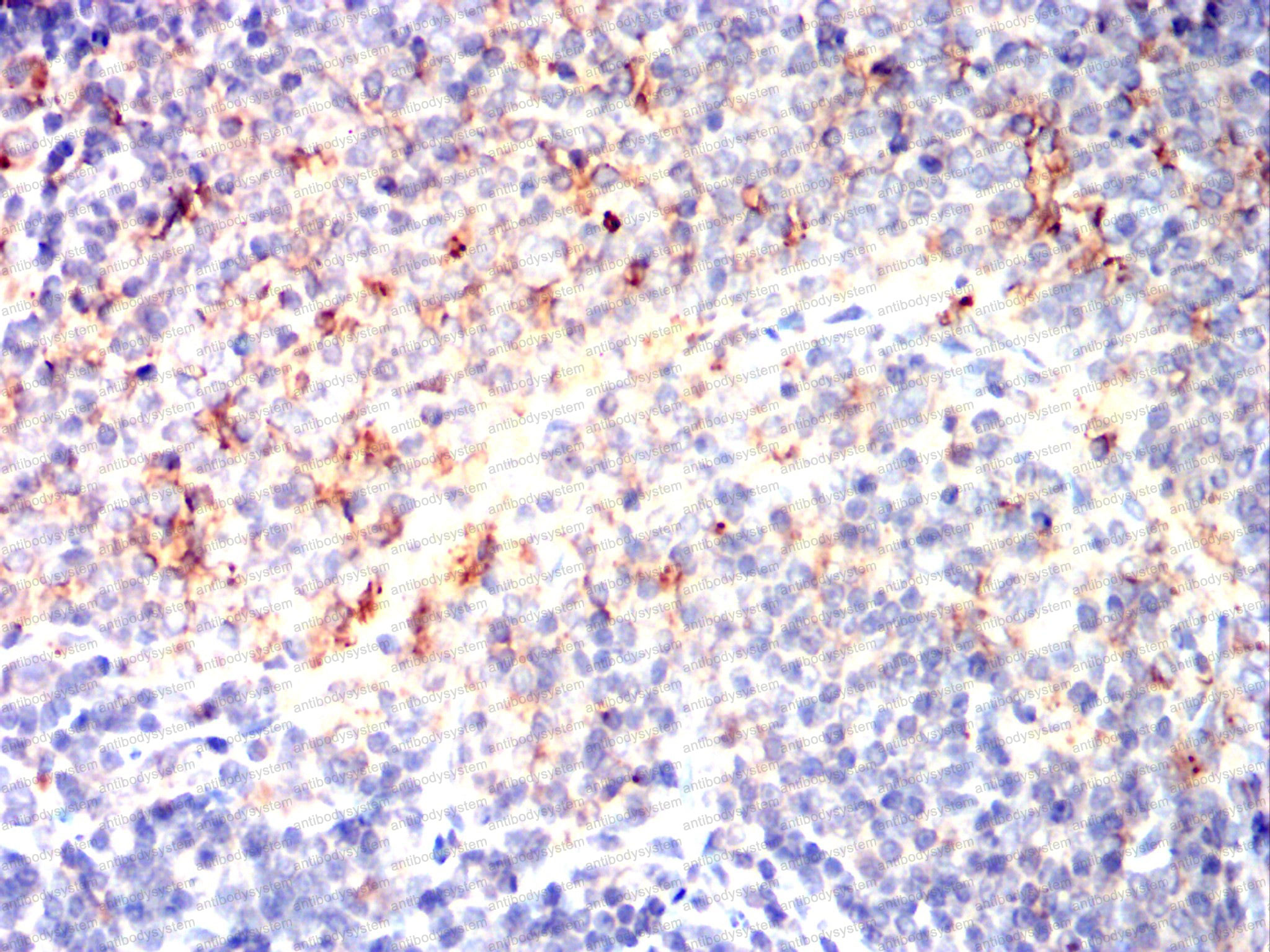 Валидация AntibodySystem RHD71002 (1745)