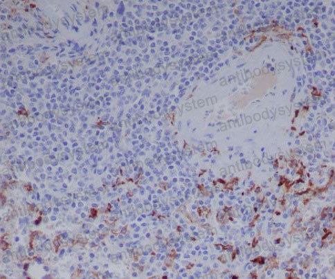 Валидация AntibodySystem RHJ92831 (3589)