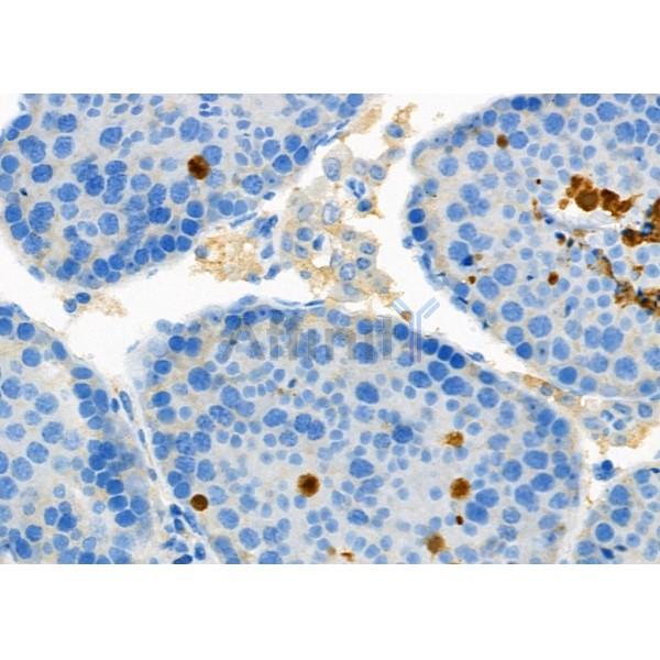 Валидация Affinity DF6651 - 18130