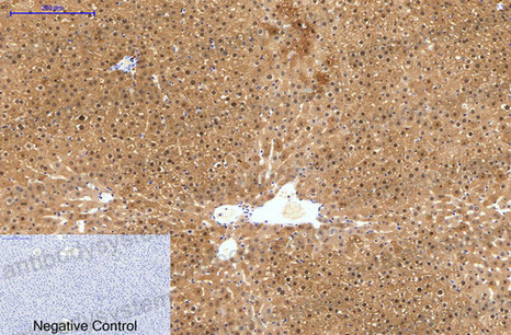 Валидация AntibodySystem RMP13401 (4198)