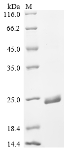 SDS-PAGE