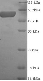 SDS-PAGE