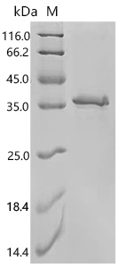 SDS-PAGE