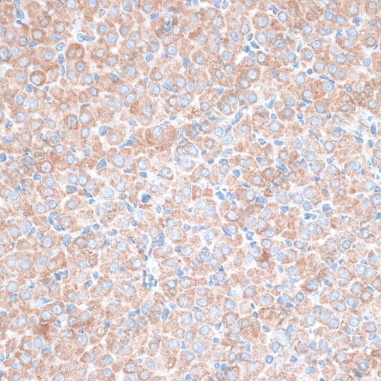 Иммуногистохимия, PMEPA1, ткань яичника крысы