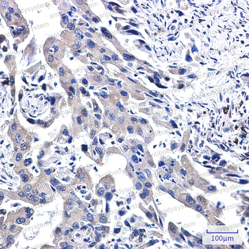 Валидация AntibodySystem RHN89601