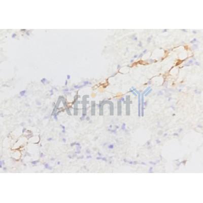 Валидация Affinity BF9208 - 5417