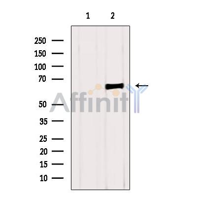 Валидация Affinity DF6863 - 18437