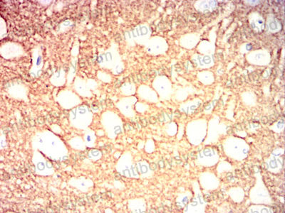 Валидация AntibodySystem RHF56704